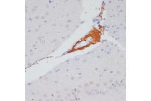 Immunohistochemistry of paraffin-embedded mouse brain using Phospho-ACLY-S455 antibody (ABIN6135178, ABIN6136002, ABIN6136003 and ABIN6225678) at dilution of 1:100 (40x lens). (ACLY antibody  (pSer455))