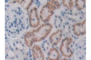 Detection of ODC in Rat Kidney Tissue using Polyclonal Antibody to Ornithine Decarboxylase (ODC) (ODC1 antibody  (AA 1-461))