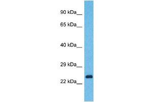 Western Blotting (WB) image for anti-Yip1 Domain Family, Member 7 (YIPF7) (N-Term) antibody (ABIN2791993) (YIPF7 antibody  (N-Term))