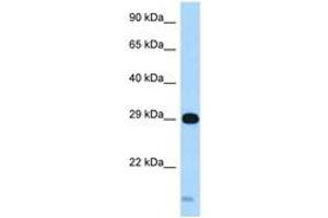 Image no. 1 for anti-Syntaxin 8 (STX8) (AA 162-211) antibody (ABIN6747939) (STX8 antibody  (AA 162-211))