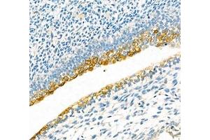 Immunohistochemistry of paraffin embedded mouse embryonic mouse using IFIT5 (ABIN7074334) at dilution of 1:300 (300x lens) (IFIT5 antibody)