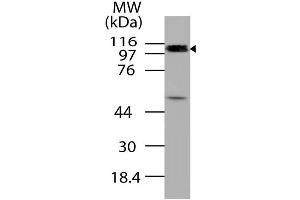 Image no. 1 for anti-Cylindromatosis (Turban Tumor Syndrome) (CYLD) (AA 1-230) antibody (ABIN5027126) (CYLD antibody  (AA 1-230))