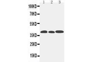 Anti-CCR5 antibody,  Western blotting Lane 1: Mouse Lung Tissue Lysate Lane 2: Mouse Intestine Tissue Lysate Lane 3: Mouse Kidney Tissue Lysate (CCR5 antibody  (N-Term))