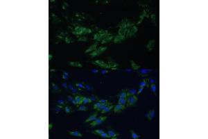 Immunofluorescence analysis of C6 cells using EPH antibody (ABIN6132064, ABIN6140215, ABIN6140216 and ABIN6224369) at dilution of 1:100. (EPH Receptor A4 antibody  (AA 887-986))