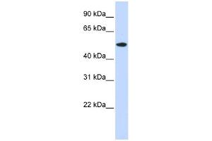 WB Suggested Anti-RASGEF1A Antibody Titration: 0. (RASGEF1A antibody  (N-Term))