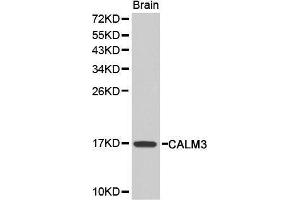 Western Blotting (WB) image for anti-Calmodulin 3 (Phosphorylase Kinase, Delta) (CALM3) (AA 1-100) antibody (ABIN3021590) (Calmodulin 3 antibody  (AA 1-100))