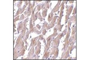 Immunohistochemistry (IHC) image for anti-Myeloid Differentiation Primary Response Gene (88) (MYD88) (AA 176-280) antibody (ABIN492527) (MYD88 antibody  (AA 176-280))