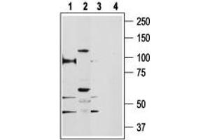 Western blot analysis of rat kidney (lanes 1 and 3) and human PC3 prostate cancer cell line (lanes 2 and 4) lysates: - 1,2. (TRPV5 antibody  (C-Term, Intracellular))