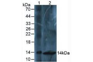Western blot analysis of (1) Mouse Liver Tissue and (2) Mouse Spinal Cord Tissue. (Osteocalcin antibody  (AA 14-95))