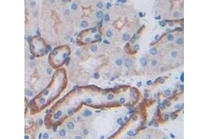 Used in DAB staining on fromalin fixed paraffin- embedded Kidney tissue (JAM3 antibody  (AA 30-241))