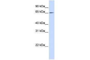 NET1 antibody used at 1 ug/ml to detect target protein. (NET1 antibody  (N-Term))