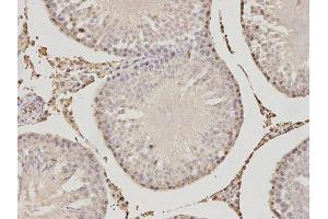 Immunohistochemistry (IHC) image for anti-Proteasome (Prosome, Macropain) Activator Subunit 1 (PA28 Alpha) (PSME1) antibody (ABIN1876546) (PSME1 antibody)
