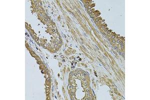 Immunohistochemistry of paraffin-embedded human prostate using MYLIP antibody (ABIN2737207) at dilution of 1:100 (40x lens).