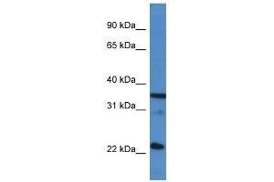 Western Blot showing SFRS2 antibody used at a concentration of 1 ug/ml against Hela Cell Lysate (SRSF2 antibody  (C-Term))