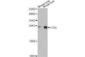 Western blot analysis of extracts of various cell lines, using C1QA Antibody (ABIN1875415) at 1:1000 dilution. (C1QA antibody)