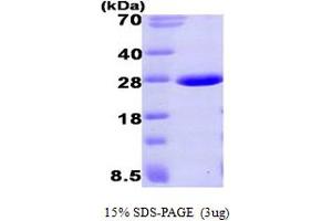 SDS-PAGE (SDS) image for Aprataxin (APTX) (AA 1-168) protein (His tag) (ABIN667764)