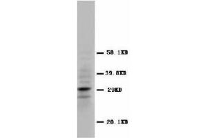 Image no. 2 for anti-Calbindin 2 (CALB2) (N-Term) antibody (ABIN1495049) (Calretinin antibody  (N-Term))