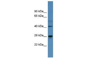Western Blotting (WB) image for anti-Carbonic Anhydrase II (CA2) (C-Term) antibody (ABIN2788328) (CA2 antibody  (C-Term))