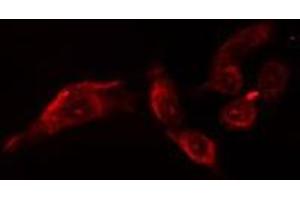 ABIN6279907 staining  Hela cells by IF/ICC. (OTUB1 antibody  (Internal Region))