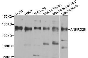 Western blot analysis of extracts of various cell lines, using ANKRD28 antibody. (ANKRD28 antibody)