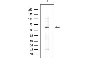 anti-Insulin-Like Growth Factor Binding Protein, Acid Labile Subunit (IGFALS) (Internal Region) antibody