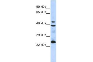 WB Suggested Anti-SEPP1 Antibody Titration: 0. (Selenoprotein P antibody  (N-Term))