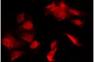 ABIN6274286 staining HT29 by IF/ICC. (DGKQ antibody  (C-Term))