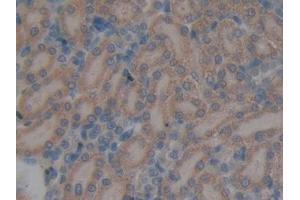 DAB staining on IHC-P; Samples: Rat Kidney Tissue (GALNS antibody  (AA 172-381))
