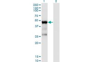 Western Blot analysis of TARBP2 expression in transfected 293T cell line by TARBP2 monoclonal antibody (M03), clone 1D9. (TARBP2 antibody  (AA 141-250))