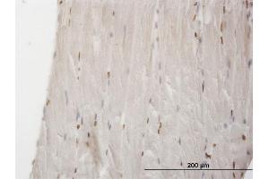 Immunoperoxidase of monoclonal antibody to MEF2BNB on formalin-fixed paraffin-embedded human skeletal muscle. (MEF2BNB antibody  (AA 1-109))