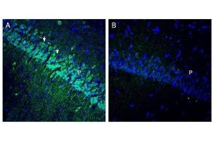 Expression of OCTN1 in rat hippocampus. (SLC22A4 antibody  (Intracellular))