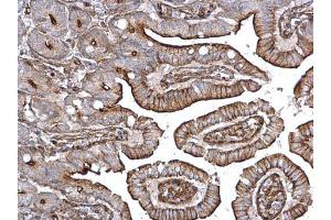IHC-P Image alpha Actinin 4 antibody [C2C3], C-term detects alpha Actinin 4 protein on mouse intestine by immunohistochemical analysis. (alpha Actinin 4 antibody  (C-Term))