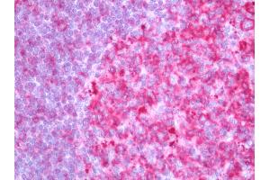 Human Tonsil: Formalin-Fixed, Paraffin-Embedded (FFPE).