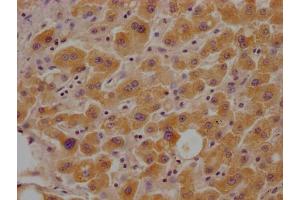 IHC image of ABIN7153713 diluted at 1:100 and staining in paraffin-embedded human liver tissue performed on a Leica BondTM system. (Glucose-6-Phosphate Dehydrogenase antibody  (AA 422-712))