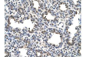 BCHE antibody was used for immunohistochemistry at a concentration of 4-8 ug/ml to stain Alveolar cells (arrows) in Human Lung. (Butyrylcholinesterase antibody  (N-Term))