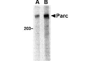 Western blot analysis of PARC in Daudi lysate with PARC antibody at (A) 1 and (B) 2 µg/mL. (CUL9 antibody  (C-Term))