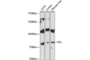Western Blotting (WB) image for anti-Involucrin (IVL) (AA 416-585) antibody (ABIN6142620)