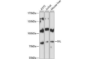 Western blot analysis of extracts of various cell lines, using IVL antibody (ABIN6128143, ABIN6142620, ABIN6142621 and ABIN6224048) at 1:3000 dilution. (Involucrin antibody  (AA 416-585))