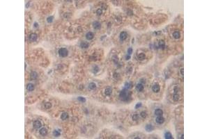 Immunohistochemistry (IHC) image for anti-alpha-2-Macroglobulin (A2M) (AA 911-1042) antibody (ABIN1857848)