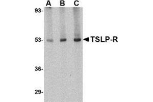 Western blot analysis of TSLP Receptor in human liver tissue lysate with this product at (A) 0. (CRLF2 antibody  (Center))