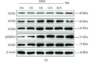 Earle's balanced salt solution (EBSS) increases NADPH oxidative activity and ROS generation in ARPE-19 cells in a time-dependent manner. (CYBB antibody  (AA 283-570))