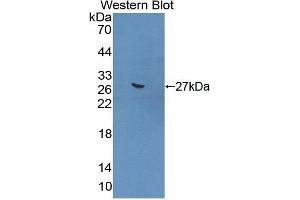 Detection of Recombinant GREM1, Mouse using Polyclonal Antibody to Gremlin 1 (GREM1) (GREM1 antibody  (AA 25-184))