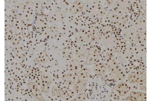 ABIN6279425 at 1/100 staining Rat kidney tissue by IHC-P. (FANCM antibody  (Internal Region))
