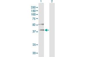 Western Blotting (WB) image for anti-Argonaute 2 (AGO2) (AA 1-377) antibody (ABIN565346)