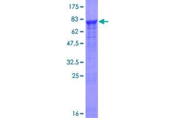 PRP19 Protein (AA 1-504) (GST tag)