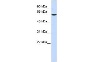 WB Suggested Anti-SPTLC1 Antibody Titration:  0. (SPTLC1 antibody  (Middle Region))