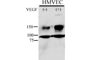 Anti-Phospho-KDR/FLK1- Pab (ABIN389564 and ABIN2839596) is used in Western blot to detect Phospho-KDR/FLK1- in HMVEC cell line lysate. (VEGFR2/CD309 antibody  (pTyr996))