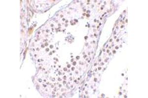 Immunohistochemical staining of human testis tissue with 10 ug/mL MED4 polyclonal antibody . (MED4 antibody  (C-Term))