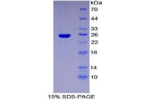SDS-PAGE analysis of Human Sprouty Homolog 3 Protein. (SPRY3 Protein)