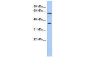 Image no. 1 for anti-ERG, ETS transcription factor (ERG) (AA 360-409) antibody (ABIN6741408) (ERG antibody  (AA 360-409))